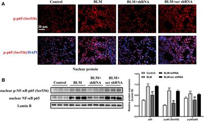 Latent Transforming Growth Factor-β Binding Protein-2 Regulates Lung Fibroblast-to-Myofibroblast Differentiation in Pulmonary Fibrosis via NF-κB Signaling